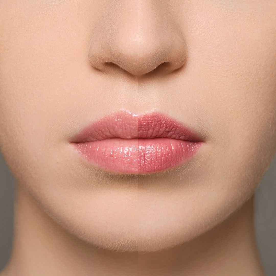 (MM003) - Supreme Lip Treatment – Fraise
